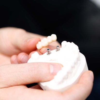 Chirurgie und Implantologie der Zahnärzte in Garbsen und Vinnhorst