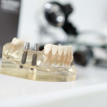 Zahnchirurgie der Zahnärzte in Garbsen und Vinnhorst
